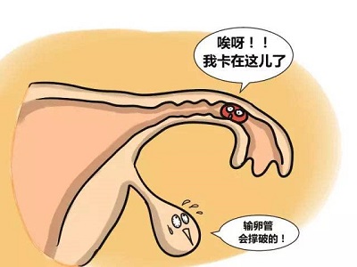 上海不孕不育医院